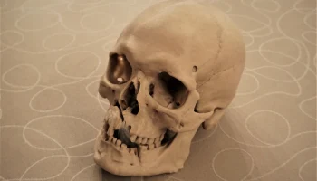 Человеческий череп с боевыми ранениями (3D-скан; Historis... 2