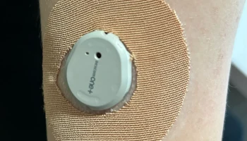 Резак для патчей Dexcom ONE - решение для диабетиков 4