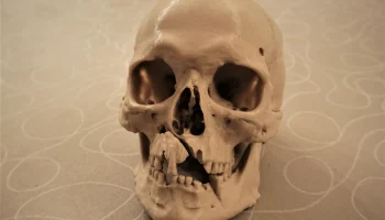 Человеческий череп с боевыми ранениями (3D-скан; Historis... 1