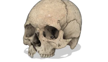 Человеческий череп с боевыми ранениями (3D-скан; Historis... 4