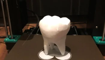 Tooth 2