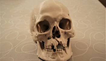 Человеческий череп с боевыми ранениями (3D-скан; Historis... Человеческий череп с боевыми ранениями (3D-скан; Historis...