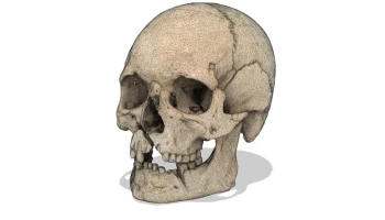 Человеческий череп с боевыми ранениями (3D-скан; Historis... 3